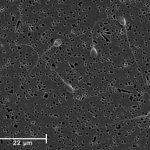 Spermatozoa-human-1000x