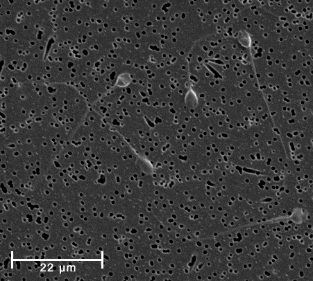 Spermatozoa-human-1000x